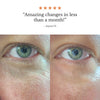 Frøya Magic Revive Eye Balm