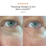 Frøya Magic Revive Eye Balm